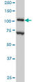 Dihydropyrimidine dehydrogenase [NADP+] antibody, LS-C197076, Lifespan Biosciences, Western Blot image 