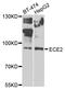 Endothelin-converting enzyme 2 antibody, STJ29129, St John