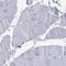 CUGBP Elav-like family member 2 antibody, HPA035813, Atlas Antibodies, Immunohistochemistry paraffin image 