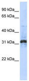 Zinc Finger Protein 705D antibody, TA339660, Origene, Western Blot image 