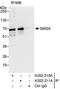 SMG9 Nonsense Mediated MRNA Decay Factor antibody, A302-210A, Bethyl Labs, Immunoprecipitation image 