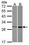 Methenyltetrahydrofolate Synthetase antibody, GTX115971, GeneTex, Western Blot image 