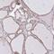 Coatomer subunit beta antibody, NBP2-39027, Novus Biologicals, Immunohistochemistry paraffin image 