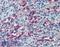Syndecan Binding Protein antibody, LS-B6146, Lifespan Biosciences, Immunohistochemistry paraffin image 