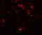 Cardiomyopathy Associated 5 antibody, A08262, Boster Biological Technology, Immunofluorescence image 