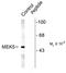 Dual specificity mitogen-activated protein kinase kinase 5 antibody, TA309169, Origene, Western Blot image 
