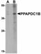 Phospholipid Phosphatase 5 antibody, LS-B4624, Lifespan Biosciences, Western Blot image 