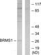 BRMS1 Transcriptional Repressor And Anoikis Regulator antibody, PA5-38800, Invitrogen Antibodies, Western Blot image 