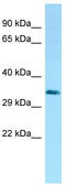 LYPD3 antibody, TA338089, Origene, Western Blot image 