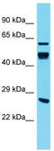 DnaJ Heat Shock Protein Family (Hsp40) Member A4 antibody, TA344847, Origene, Western Blot image 