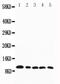 C-C Motif Chemokine Ligand 4 antibody, PA1379, Boster Biological Technology, Western Blot image 