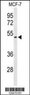 CCT antibody, 64-063, ProSci, Western Blot image 