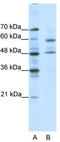 Transcription Factor CP2 Like 1 antibody, TA330623, Origene, Western Blot image 
