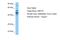 Zinc Finger Protein 519 antibody, A17667, Boster Biological Technology, Western Blot image 