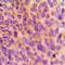 Mitochondrial Ribosomal Protein L10 antibody, LS-C353621, Lifespan Biosciences, Immunohistochemistry paraffin image 