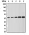 Glucosamine (N-Acetyl)-6-Sulfatase antibody, abx225195, Abbexa, Western Blot image 