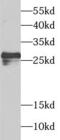 Spindlin Family Member 2B antibody, FNab08179, FineTest, Western Blot image 