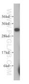 Peroxisomal trans-2-enoyl-CoA reductase antibody, 14901-1-AP, Proteintech Group, Western Blot image 
