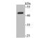 Cytochrome P450 Family 26 Subfamily A Member 1 antibody, NBP2-76826, Novus Biologicals, Western Blot image 