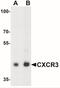 C-X-C Motif Chemokine Receptor 3 antibody, NBP2-41250, Novus Biologicals, Western Blot image 
