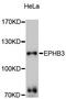 EPH Receptor B3 antibody, STJ112252, St John