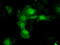 Aldo-Keto Reductase Family 1 Member A1 antibody, TA500745, Origene, Immunofluorescence image 