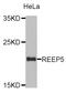 Receptor Accessory Protein 5 antibody, STJ26564, St John