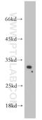 Spi-1 Proto-Oncogene antibody, 55100-1-AP, Proteintech Group, Western Blot image 