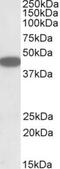 C-X-C Motif Chemokine Receptor 6 antibody, NBP1-52034, Novus Biologicals, Western Blot image 