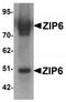 Zinc transporter ZIP6 antibody, TA319873, Origene, Western Blot image 