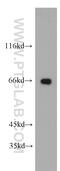 Ubiquitin carboxyl-terminal hydrolase 22 antibody, 55110-1-AP, Proteintech Group, Western Blot image 