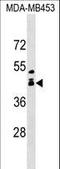 ALX Homeobox 1 antibody, LS-C161046, Lifespan Biosciences, Western Blot image 