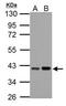 Peroxisomal 3,2-trans-enoyl-CoA isomerase antibody, GTX123400, GeneTex, Western Blot image 