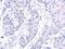 Zinc Finger Protein 571 antibody, PA5-31499, Invitrogen Antibodies, Immunohistochemistry frozen image 
