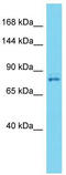 Vacuolar protein sorting-associated protein 35 antibody, TA344911, Origene, Western Blot image 