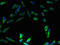 ATPase H+ Transporting V1 Subunit E1 antibody, LS-C211159, Lifespan Biosciences, Immunofluorescence image 