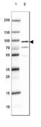 Dipeptidyl Peptidase Like 6 antibody, NBP2-47481, Novus Biologicals, Western Blot image 