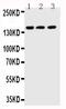 ATP Binding Cassette Subfamily B Member 11 antibody, PA1393, Boster Biological Technology, Western Blot image 