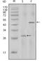 Interleukin 2 antibody, M00387, Boster Biological Technology, Western Blot image 