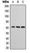 POTE Ankyrin Domain Family Member G antibody, orb315810, Biorbyt, Western Blot image 