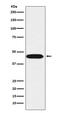 Platelet Activating Factor Acetylhydrolase 1b Regulatory Subunit 1 antibody, M01273, Boster Biological Technology, Western Blot image 