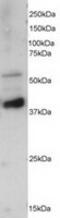Protein Phosphatase 2 Regulatory Subunit B'Epsilon antibody, TA302739, Origene, Western Blot image 