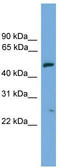 Exocyst Complex Component 4 antibody, TA336017, Origene, Western Blot image 