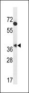 Muscleblind-like protein 2 antibody, LS-C164061, Lifespan Biosciences, Western Blot image 