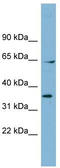 Ran GTPase Activating Protein 1 antibody, TA342186, Origene, Western Blot image 