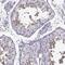 RAD52 motif-containing protein 1 antibody, NBP2-62656, Novus Biologicals, Immunohistochemistry paraffin image 