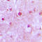 Cyclin Dependent Kinase 10 antibody, LS-C353066, Lifespan Biosciences, Immunohistochemistry frozen image 