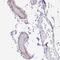 EMAP Like 5 antibody, PA5-62898, Invitrogen Antibodies, Immunohistochemistry paraffin image 