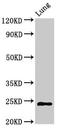 Charged Multivesicular Body Protein 6 antibody, LS-C378740, Lifespan Biosciences, Western Blot image 