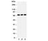 Solute Carrier Family 6 Member 4 antibody, R30794, NSJ Bioreagents, Western Blot image 